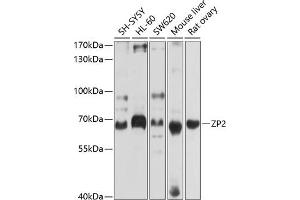 Western blot analysis of extracts of various cell lines, using ZP2 antibody (ABIN6128965, ABIN6150534, ABIN6150535 and ABIN6214263) at 1:1000 dilution. (ZP2 anticorps  (AA 651-745))