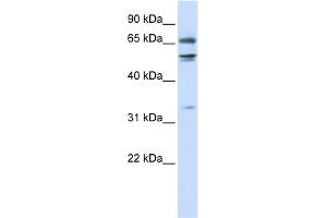 WB Suggested Anti-MED26 Antibody Titration:  0. (MED26 anticorps  (N-Term))