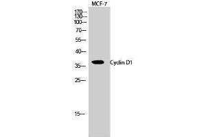 Western Blotting (WB) image for anti-Cyclin D1 (CCND1) (Ser166) antibody (ABIN3174618) (Cyclin D1 anticorps  (Ser166))