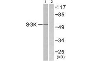 Western blot analysis of extracts from 293 cells, treated with heat shock, using SGK (Ab-78) Antibody. (SGK1 anticorps  (AA 41-90))