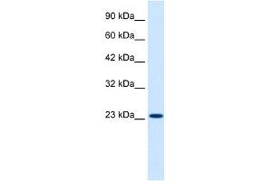 WB Suggested Anti-KCNIP2 Antibody Titration:  0. (KCNIP2 anticorps  (N-Term))