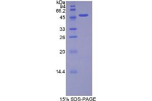 SDS-PAGE analysis of Rat FGF10 Protein. (FGF10 Protéine)
