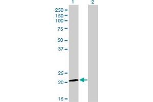 Western Blot analysis of ATF3 expression in transfected 293T cell line by ATF3 monoclonal antibody (M01), clone 6B8.