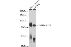 Western blot analysis of extracts of various cell lines, using ENTPD1/CD39 antibody (ABIN1679729, ABIN3018088, ABIN3018089 and ABIN6220354) at 1:1000 dilution. (CD39 anticorps  (AA 1-180))