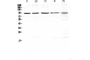 Western blot analysis of PRDM1/Blimp1 using anti-PRDM1/Blimp1 antibody . (PRDM1 anticorps  (AA 1-230))