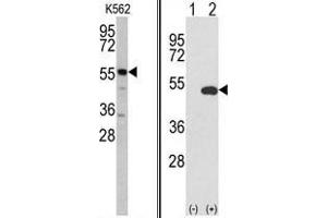 (LEFT) Western blot analysis of GPT antibody (N-term R133) in K562 cell line lysates (35 µg/lane). (ALT anticorps  (N-Term))