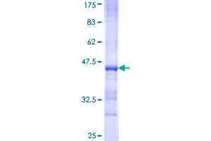 Image no. 1 for Aggrecan (ACAN) (AA 56-155) protein (GST tag) (ABIN1305600)