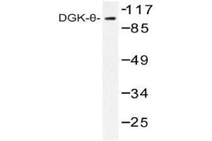 Western blot (WB) analysis of DGK-theta antibody in extracts from HT-29 cells. (DGKQ anticorps)