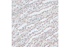 Immunohistochemistry of paraffin-embedded mouse kidney using ZNF597 antibody  at dilution of 1:100 (40x lens).