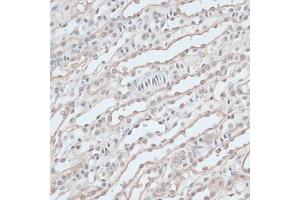 Immunohistochemistry of paraffin-embedded mouse kidney using ZNF597 antibody  at dilution of 1:100 (40x lens). (ZNF597 anticorps  (AA 1-140))