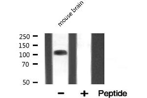 Western blot analysis of EIF4G2 expression in Mouse brain lysate