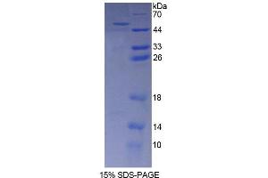 SDS-PAGE analysis of Mouse AASS Protein.