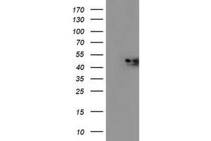Western Blotting (WB) image for anti-NADH Dehydrogenase (Ubiquinone) Complex I, Assembly Factor 7 (NDUFAF7) antibody (ABIN1499667) (NDUFAF7 anticorps)