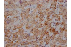 IHC image of ABIN7127865 diluted at 1:100 and staining in paraffin-embedded human liver tissue performed on a Leica BondTM system.