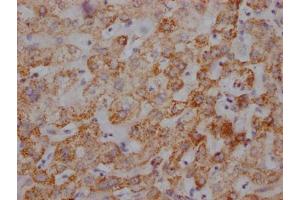 IHC image of ABIN7127865 diluted at 1:100 and staining in paraffin-embedded human liver tissue performed on a Leica BondTM system. (Recombinant UQCRC2 anticorps)