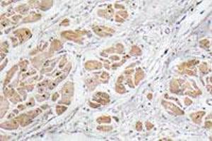 Immunohistochemical staining of paraffin-embedded human heart tissue with GNRH1 polyclonal antibody . (GNRH1 anticorps)