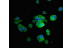 Immunofluorescent analysis of MCF-7 cells using ABIN7149238 at dilution of 1:100 and Alexa Fluor 488-congugated AffiniPure Goat Anti-Rabbit IgG(H+L)