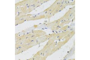 Immunohistochemistry of paraffin-embedded rat heart using TRAP1 Antibody (ABIN1875197) at dilution of 1:100 (40x lens). (TRAP1 anticorps)