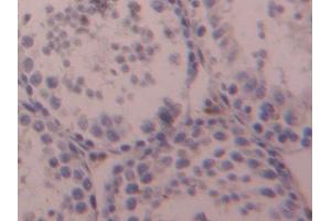 DAB staining on IHC-P; Samples: Mouse Testis Tissue (OTUB1 anticorps  (AA 1-271))