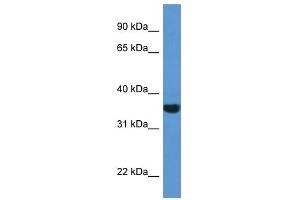 Western Blot showing NQO1 antibody used at a concentration of 1 ug/ml against 721_B Cell Lysate (NQO1 anticorps  (C-Term))