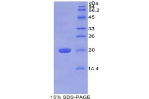 SDS-PAGE analysis of Human Galactosylceramidase Protein. (GALC Protéine)