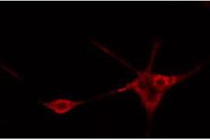 ABIN6269113 staining Hela cells by IF/ICC. (Ret Proto-Oncogene anticorps  (C-Term))