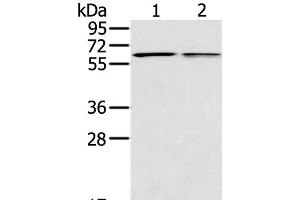 Western Blot analysis of Mouse liver and lung tissue using PTGER2 Polyclonal Antibody at dilution of 1:200 (PTGER2 anticorps)