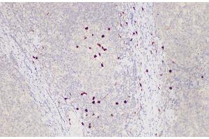 Immunohistochemistry of paraffin-embedded Human tonsil using S100A12 Polycloanl Antibody at dilution of 1:85 (S100A12 anticorps)