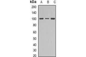 Western blot analysis of Dynamin 1 expression in NIH3T3 (A), mouse brain (B), PC12 (C) whole cell lysates.