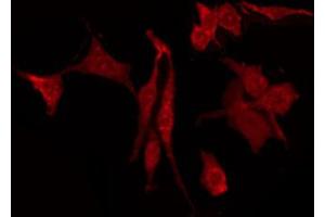 ABIN6274407 staining HepG2 by IF/ICC. (DOK3 anticorps  (Internal Region))