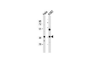 All lanes : Anti-CTDSPL Antibody (N-term) at 1:1000 dilution Lane 1: Hela whole cell lysate Lane 2: K562 whole cell lysate Lysates/proteins at 20 μg per lane. (CTDSPL anticorps  (N-Term))