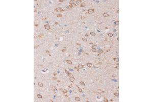 Immunohistochemistry of paraffin-embedded Rat brain using STIM2 Rabbit pAb (ABIN7270611) at dilution of 1:100 (40x lens).