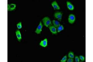 Immunofluorescent analysis of A549 cells using ABIN7150558 at dilution of 1:100 and Alexa Fluor 488-congugated AffiniPure Goat Anti-Rabbit IgG(H+L) (DNAJC4 anticorps  (AA 1-155))