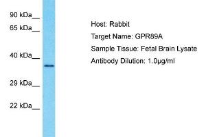 Host: Rabbit Target Name: GPR89A Sample Type: Fetal Brain lysates Antibody Dilution: 1. (GPR89A anticorps  (C-Term))