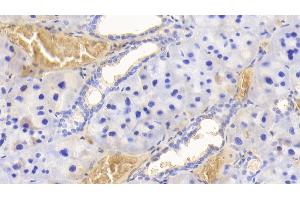 Detection of HB in Rat Adrenal gland Tissue using Polyclonal Antibody to Hemoglobin (HB) (Hemoglobin anticorps)