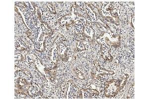IHC analysis of Methylmalonyl Coenzyme A using anti-Methylmalonyl Coenzyme A antibody (ABIN7603112). (MUT anticorps  (N-Term))