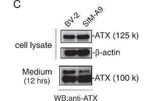 The autotaxin (ATX) inhibitor BI-2545 promotes lysophosphatidylcholine (LPC) -mediated cell morphology.