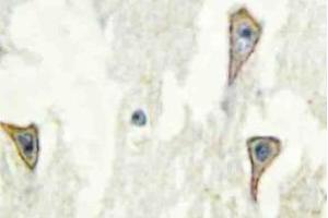 Immunohistochemistry (IHC) analyzes of A Cyclase I antibosy in paraffin-embedded human brain tissue. (ADCY1 anticorps)