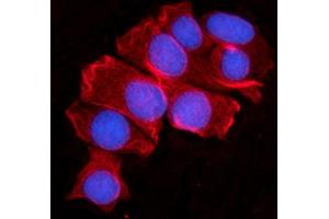 IF analysis of MOV10 using anti-MOV10 antibody (ABIN7600236). (MOV10 anticorps  (AA 167-772))