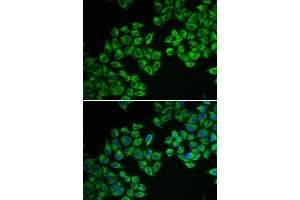 Immunofluorescence analysis of A549 cell using HMGCR antibody.