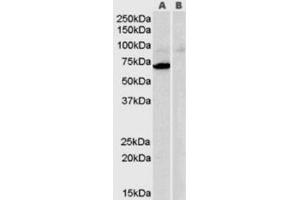 Western Blotting (WB) image for anti-Monoamine Oxidase A (MAOA) (Internal Region) antibody (ABIN2465953) (Monoamine Oxidase A anticorps  (Internal Region))