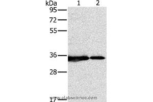 Western blot analysis of 231 and Jurkat cell, using NDUFAF1 Polyclonal Antibody at dilution of 1:500 (NDUFAF1 anticorps)