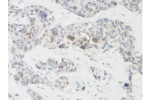 Immunohistochemistry (IHC) image for anti-Nephroblastoma Overexpressed (NOV) antibody (ABIN2474328) (NOV anticorps)