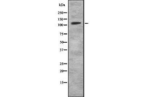 Western blot analysis of MKL2 using HuvEc whole cell lysates (MKL2 anticorps  (Internal Region))