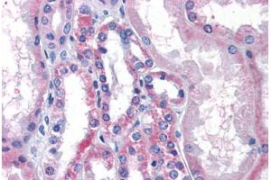 Kidney, Human: Formalin-Fixed, Paraffin-Embedded (FFPE)