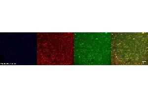 Immunohistochemistry (IHC) image for anti-Platelet Derived Growth Factor Receptor beta (PDGFRB) antibody (ABIN7456120)