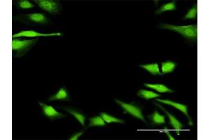 Immunofluorescence of purified MaxPab antibody to DUSP23 on HeLa cell. (DUSP23 anticorps  (AA 1-150))