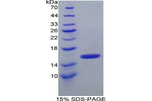 SDS-PAGE of Protein Standard from the Kit  (Highly purified E. (ITIH4 Kit ELISA)