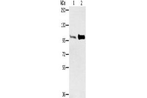 Western Blotting (WB) image for anti-Actinin, alpha 2 (ACTN2) antibody (ABIN2427122) (ACTN2 anticorps)
