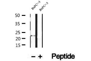 Western blot analysis of extracts of BxPC-3 cells, using REEP6 antibody. (REEP6 anticorps  (C-Term))